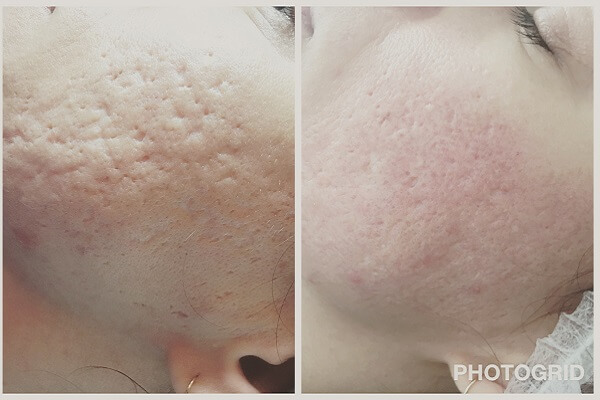 Isabel Medical Day Spa