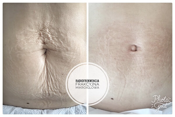 Isabel Medical Day Spa